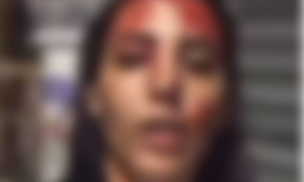 Mulher presa após esfaquear namorado alega violência doméstica; veja vídeo